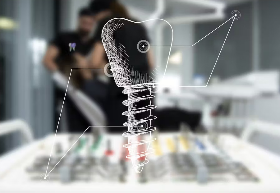 انواع روش های ایمپلنت دندان