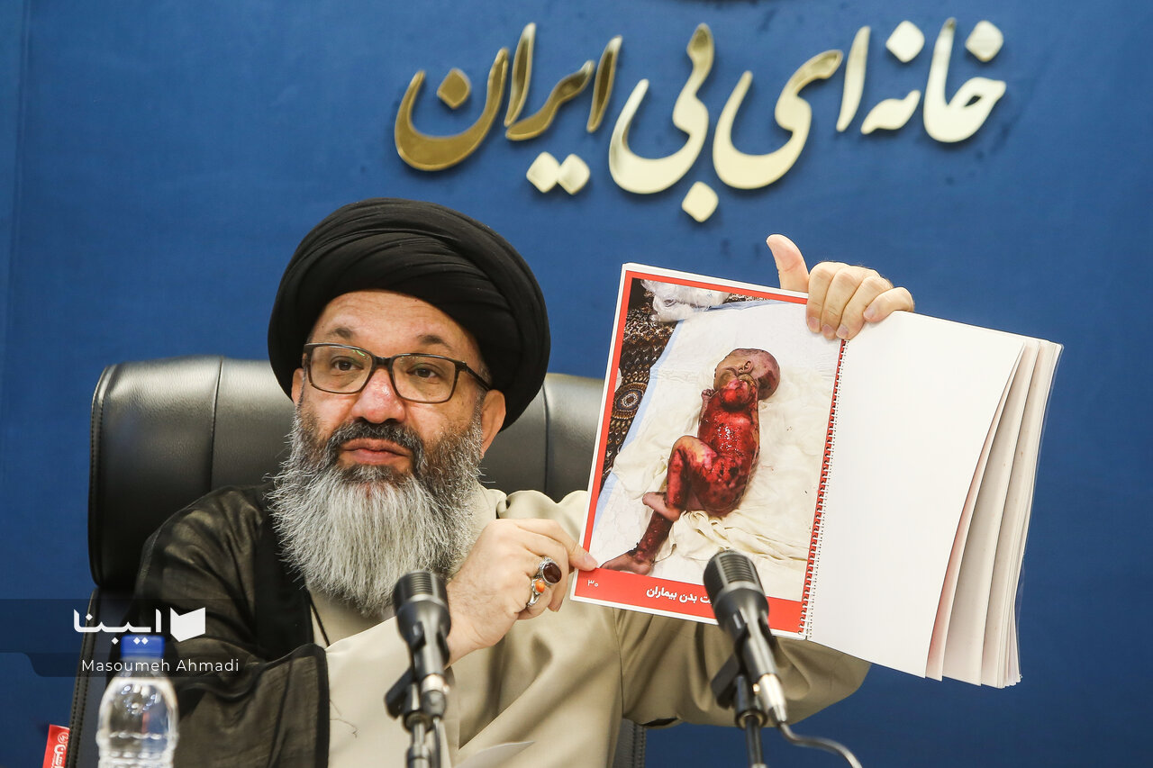 مستند فروغ فرخزاد در شناسایی و التیام درد جزام معجزه کرد