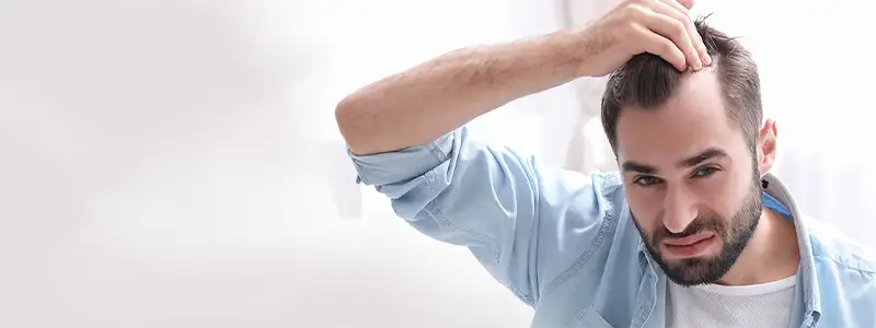 کاشت مو در ایلام | بررسی روش ها، مزایا و مراقبت های بعد از عمل