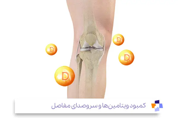 نقش تغذیه در آرتروز زانو