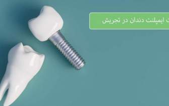 قیمت ایمپلنت دندان در تجریش