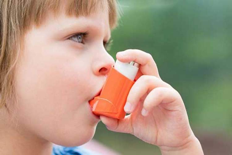 التهاب پارانشیم ریه، علت عفونی پیشتاز در مرگ کودکان زیر 5 سال